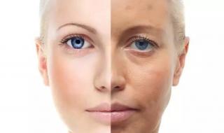 最好的胶原蛋白